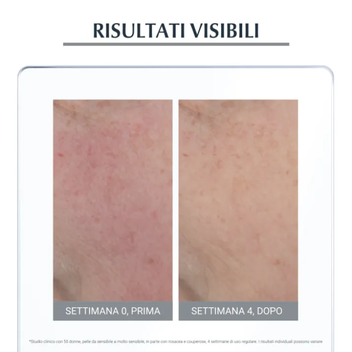 Anti-Rose Trattamento Giorno Neutralizzante Fp30 Eucerin® 50ml