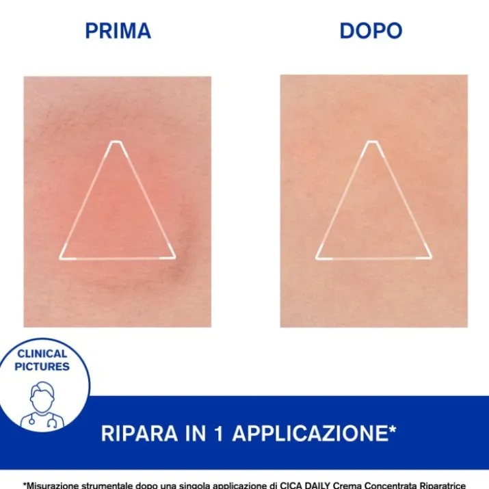 Bariéderm Cica Daily Gel Crème Uriage 40ml
