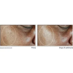 Crema Giorno Tonificante Liftante Multi Correction®️ Roc 50ml