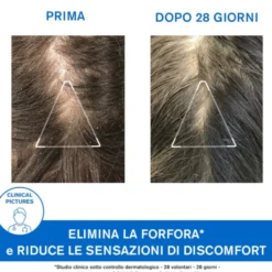 DS Hair Shampoo Trattamento Antiforfora Uriage 200ml