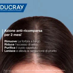 Ducray Kelual Squanorm Shampoo Trattante Regolatore Forfora Grassa, 400 ml