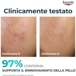 EUCERIN DC TRATTAMENTO RINN